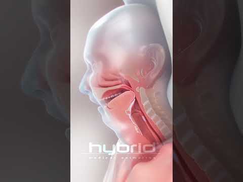 Sleep apnea animation | #OSA #ObstructiveSleepApnea #SleepAnimation #SleepApnea