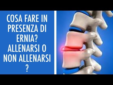 Sinovite dei muscoli della spalla Malattia intestinale in cui il dolore ha lasciato