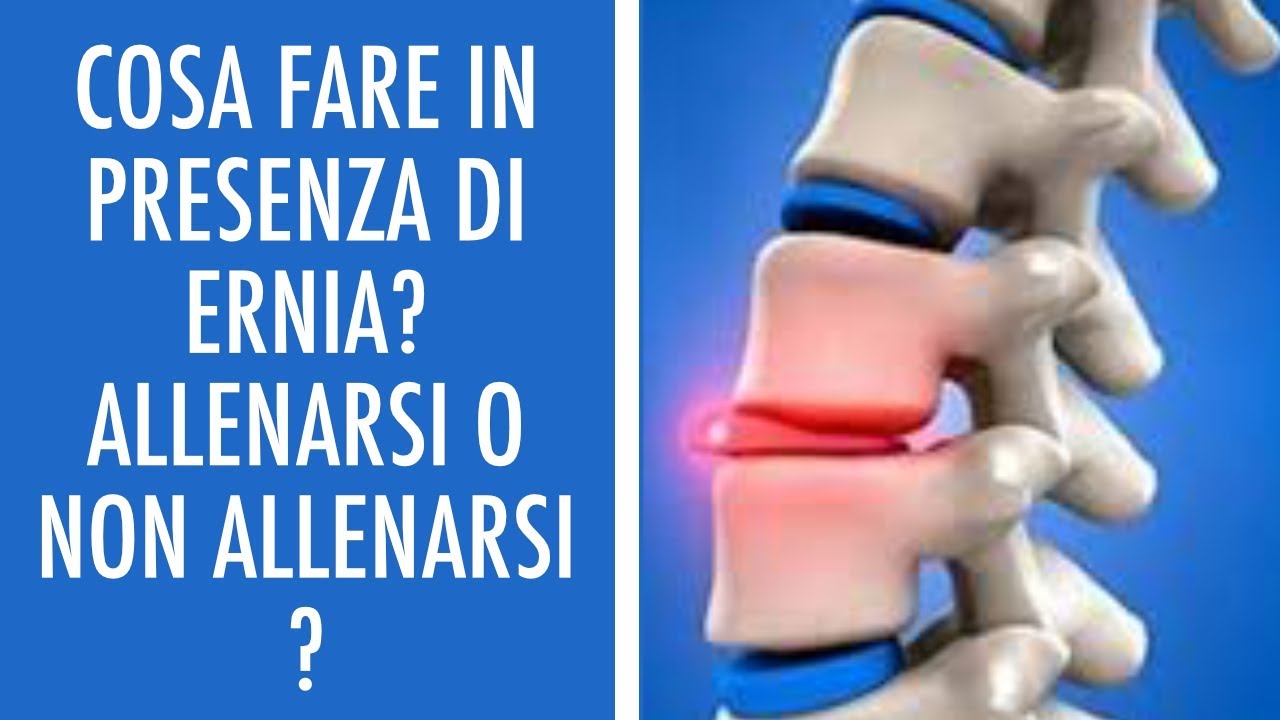 ERNIA DEL DISCO E ALLENAMENTO IN PALESTRA: SI PUÒ FARE CONSIGLI