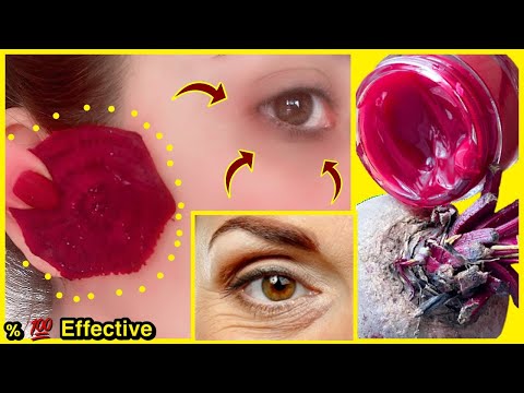 , title : 'I Mixed Beetroot With This Oil, Removed Under Eye Wrinkles, Dark Circles in 20 Minutes- Whiten Face'