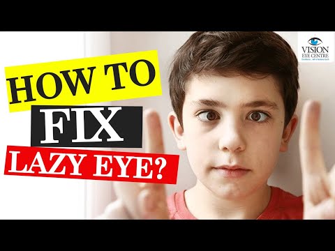 How to Fix Lazy Eye Naturally or with Surgery? | What is Lazy Eye (Amblyopia) and its Treatment