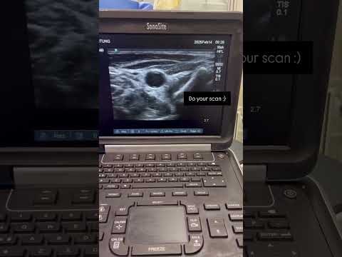 Sonosite - how to record your echo findings