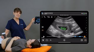 OB AI for Crown Rump Length (CRL)
