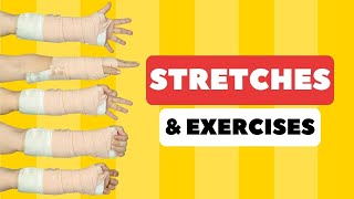 Tight Fingers & Hand after Cast (Broken Wrist) Stretches & Exercises