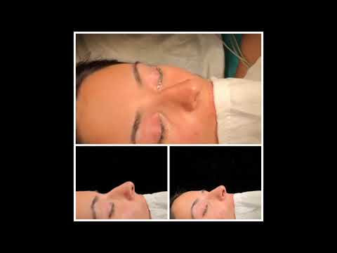 Op.Dr.Yunus Kan Rhinoplasty Results