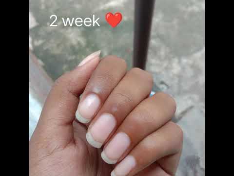 nail growth journey of 2 months 💅 #nailart#viral#trending#shorts