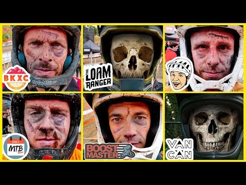 Not All of Us Survived... | EWS Whistler - Day 2