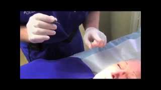 preview picture of video 'Facial Vein Treatment Tampa (813) 501-2706 Spider Vein Treatment for Face Tampa'