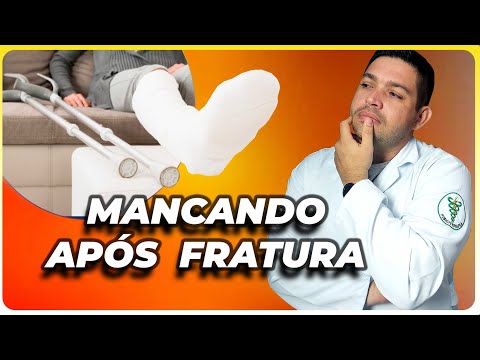 Fui Liberado para Pisar após Fratura de Tíbia mas estou Mancando e agora?