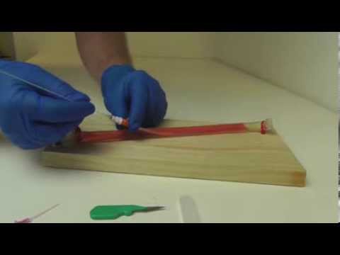 How to save a life with a 20G IV