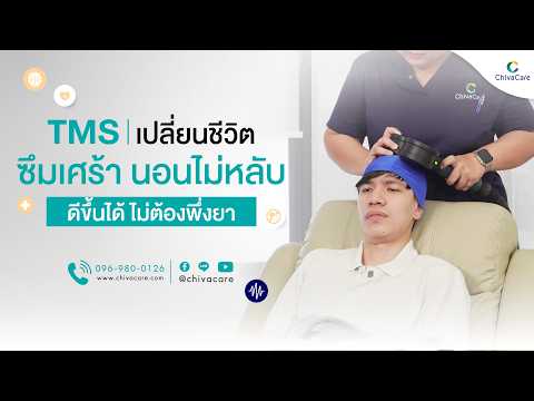 ประสบการณ์การรักษา TMS และผลลัพธ์จริง