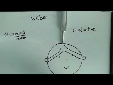 Weber Test made easy Sensoneural/Conductive hearing loss USMLE