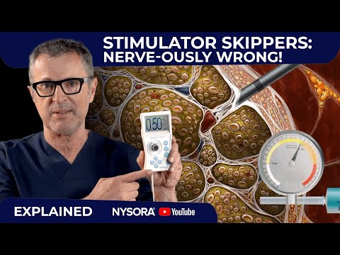 It's Time to Rediscover Your Nerve Stimulator!