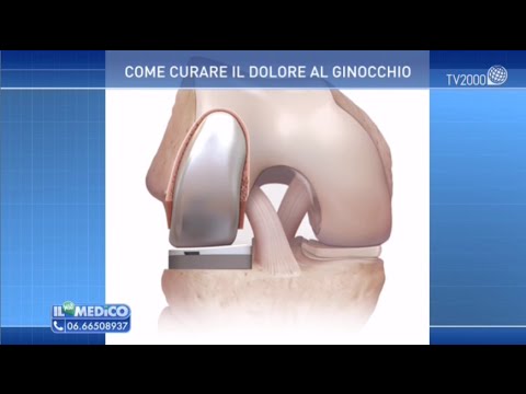 Come determinare lemartro ginocchio Il trattamento della protrusione della colonna vertebrale di San Pietroburgo