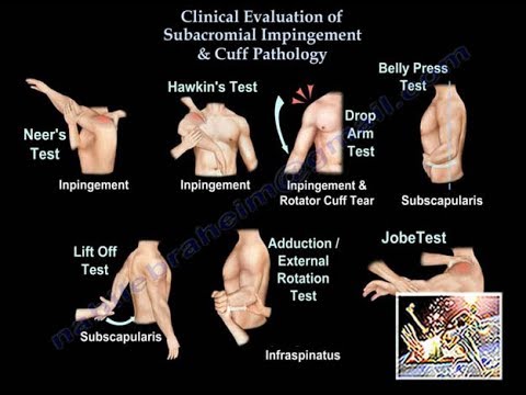 Clinical Examination Of Shoulder & Rotator Cuff - Everything You Need To Know - Dr. Nabil Ebraheim