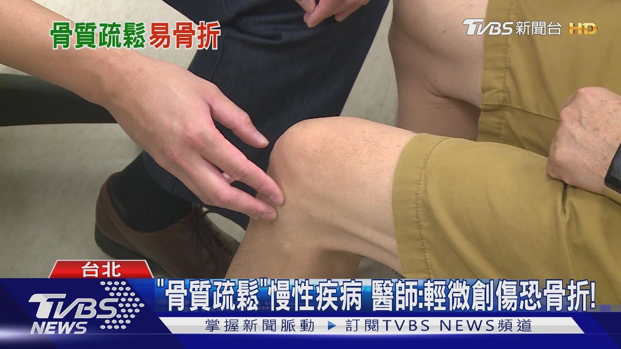 輕忽「骨質疏鬆」易造成三個部位骨折 病情嚴重恐致死