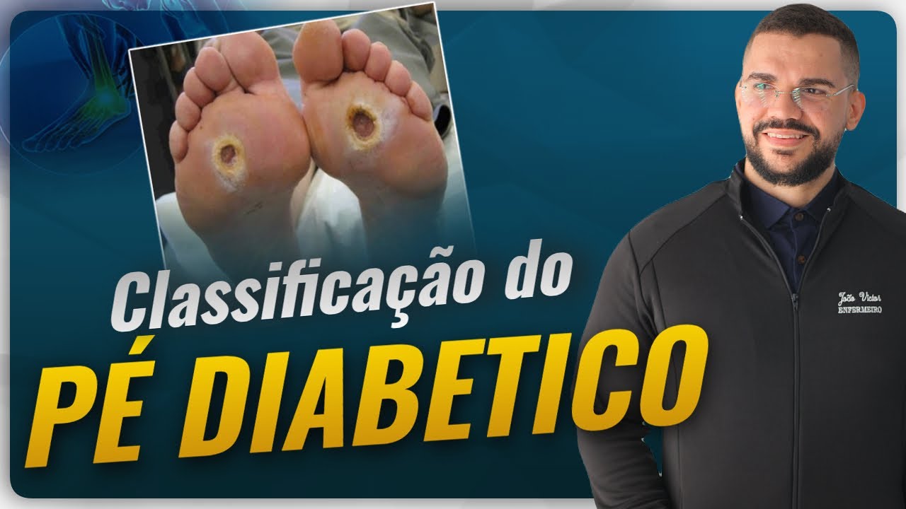 ENTENDA COMO É A CLASSIFICAÇÃO DO PÉ DIABETICO