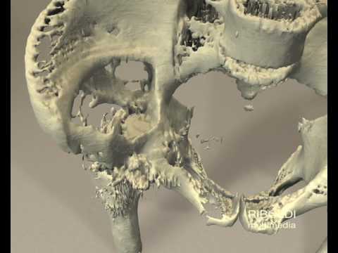 Perché danneggiare le articolazioni della colonna vertebrale Pomata per il dolore alle articolazioni dellanca recensioni