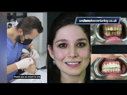 Videos from Smile Makeover Turkey