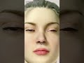 How Septoplasty Is Done 3D Animation How Septoplasty Septum Nose 3danimation