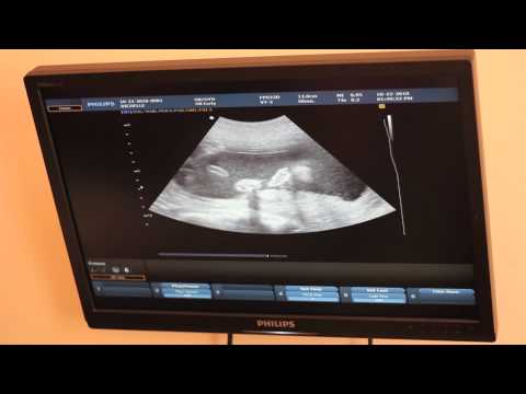 "Oh, Herro!" Baby Moh Speaks!! Week 22 Pregnancy Vlog