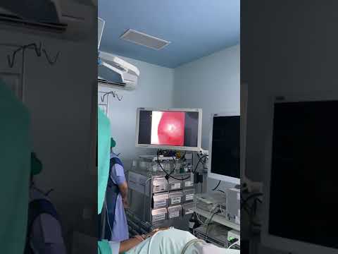 Flexible Ureteroscope, RIRS