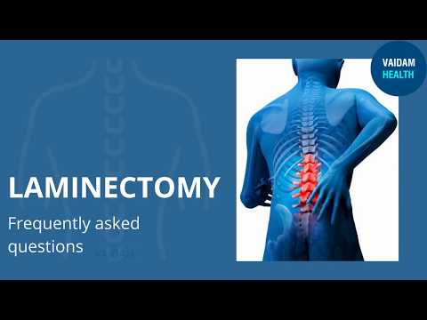 Laminectomy - Frequently Asked Questions