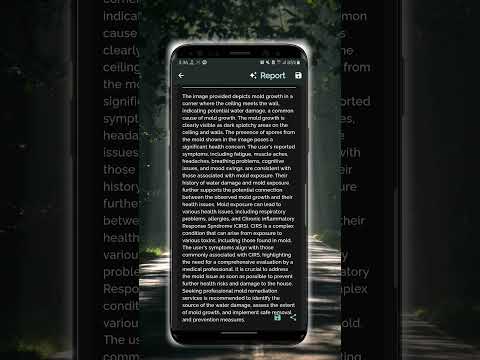 Anecdotal AI