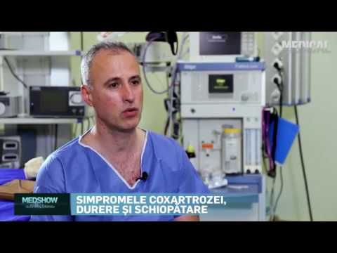 Osteoporoza simptome tratamentul articulației cotului