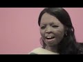Chhapaak Deepika Padukone New Hindi Movie T Series Chhapaak
