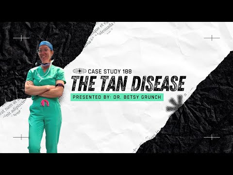 Case Study 188: Addison’s Disease | Primary Adrenal Insufficiency | Dr. Betsy Grunch explains