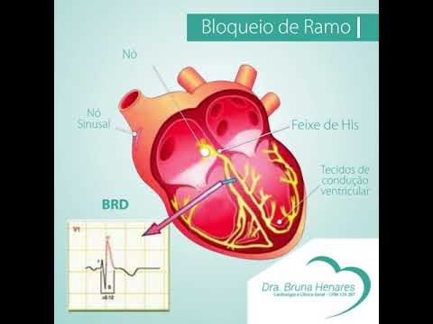 Bloqueio de Ramo