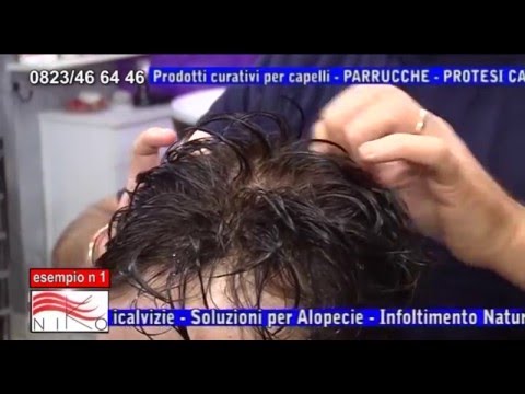 Cosa fare se una ragazza eccitata Alcune radici con limpotenza