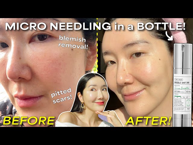 VT - Reedle Shot 100 ريديل شوت 100