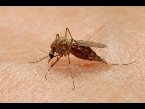 Corsetti spinali osteocondrosi Che il miglior aiuto di mal di schiena