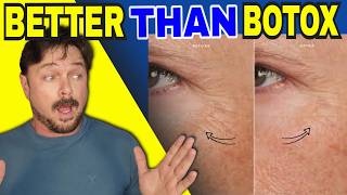 Castor Oil Works Better And Cost Less Than Botox