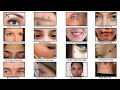 All Major Face Piercings Explained In 11 Minutes