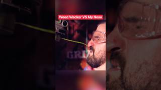Weed Wacker VS My Nose… Instant Regret #shorts #funny #comedy