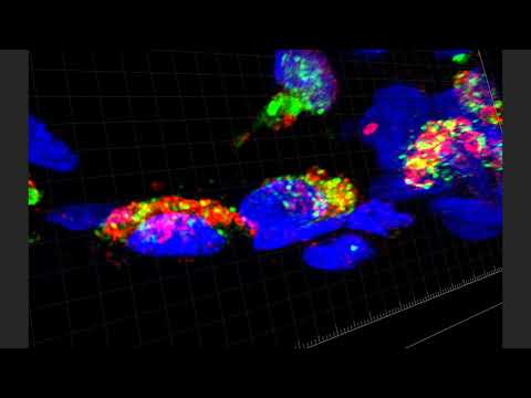 4 Month-Old Human Lung D075 4 Month-Old Human Lung D075
