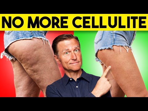 The FASTEST Way to Lose Cellulite