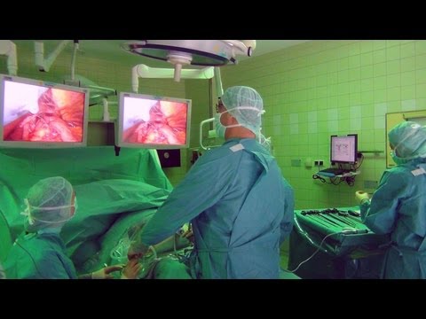 Die Lage der Prostata in dem Körper Verkalkungen in der Prostata Körper