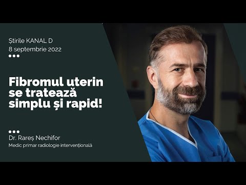 Fibromul uterin se tratează simplu și rapid! I Dr. Rareș Nechifor
