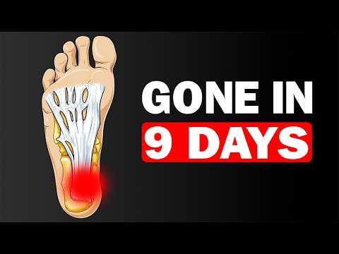 ONE Simple Trick To Fix PLANTAR FASCIITIS Forever