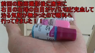 右目の右端の白目の充血が治らないので眼科へ行ってきました！！