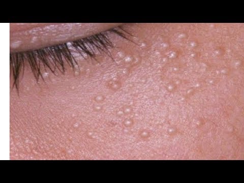 Quanto donna Excite Unguenti per lingrandimento del pene rimedi popolari