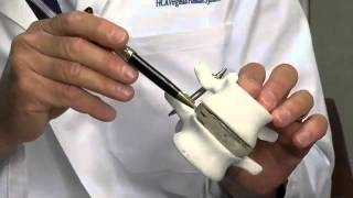 Dr. Leipzig Treats Spinal Stenosis