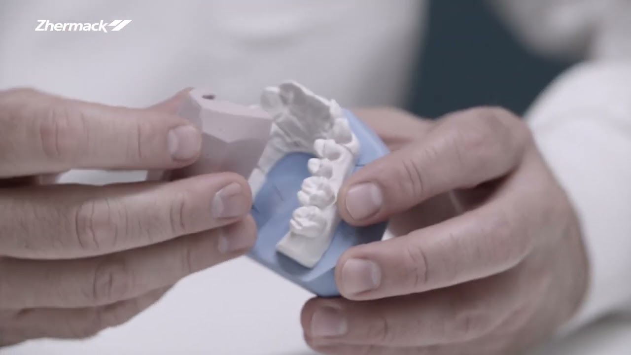 Vidéo de démonstration — Gingifast en laboratoire dentaire pour masque gingival sur prothèse