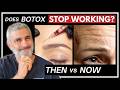 When Botox And Fillers Stop Working And What To Do Instead