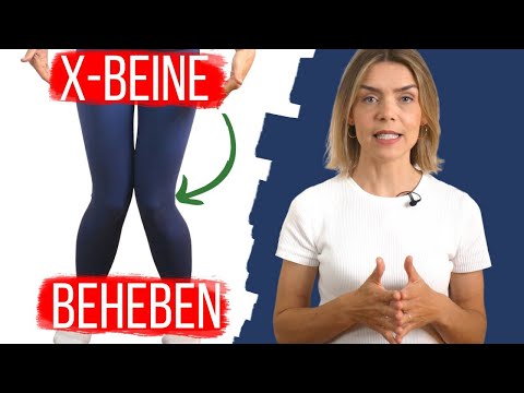 What causes knock-knees pain and how to improve it