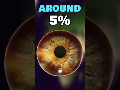 The Rarest Eye Colors In The World